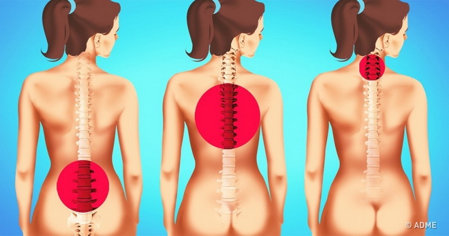 Jednominutne vježbe istezanja koje će vas poštedjeti bolova u leđima